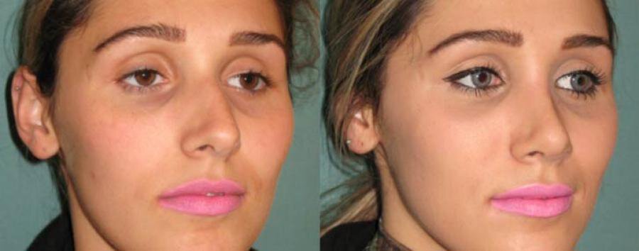 WHAT IS A PERFECT NOSE?
