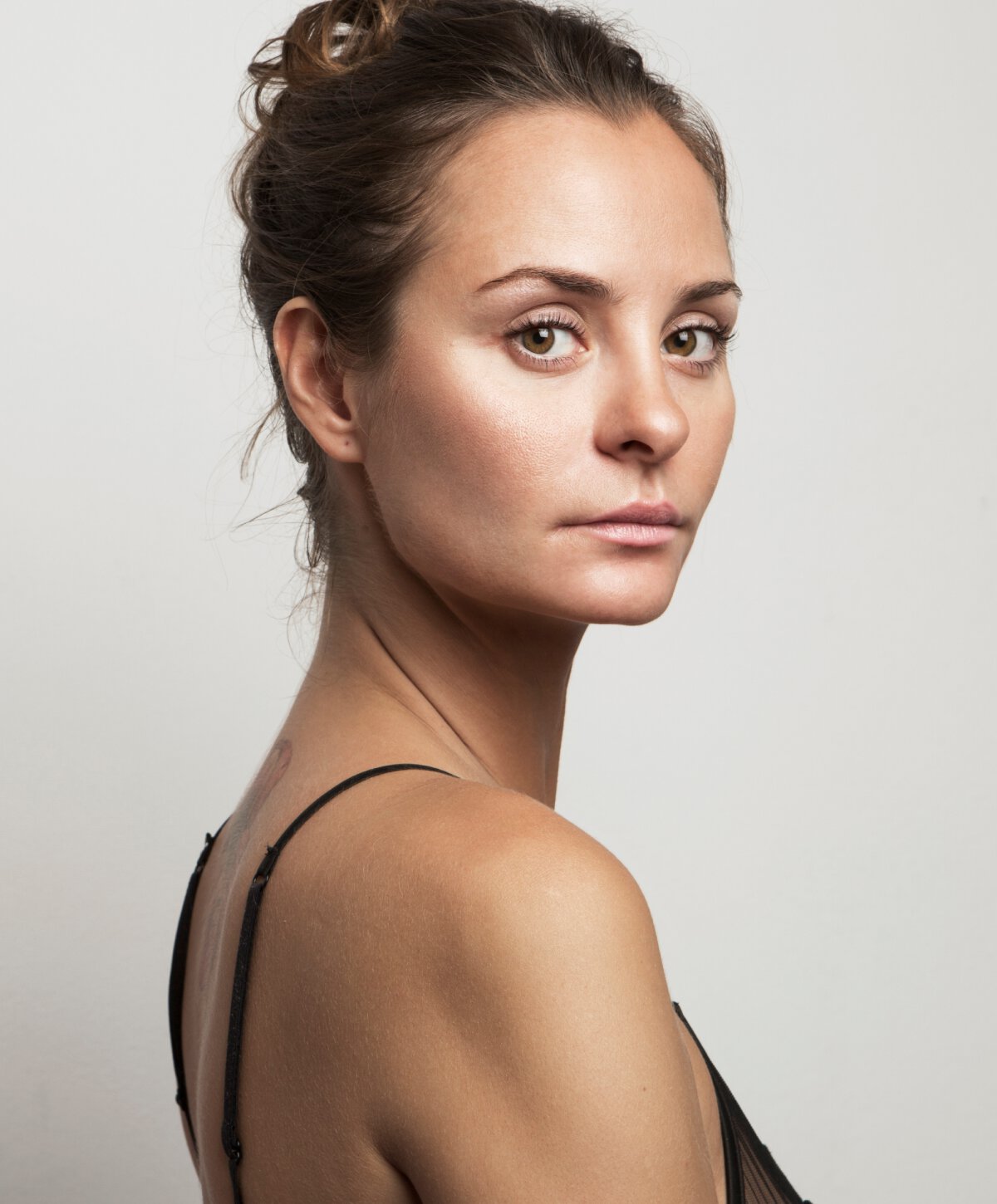 Northfield non-surgical facelift model