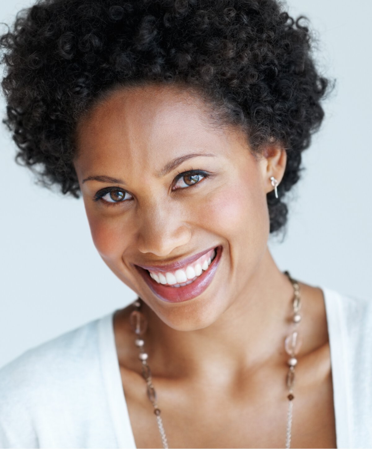 Northfield chin implant model smiling